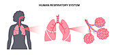 Lung diseases, illustration