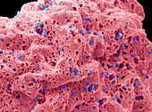 Adenovirus, SEM