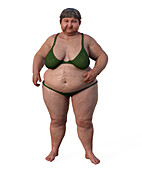 Woman with overweight body composition, illustration