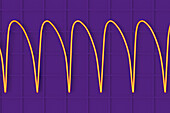 Ventricular tachycardia heartbeat rhythm, illustration