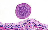Corpus amylaceous and prostate gland cells, light micrograph