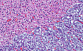 Adrenal cortex and medulla cells, light micrograph