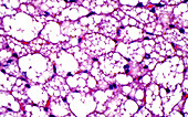 Brown fat cells, light micrograph