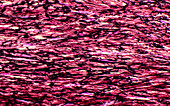 Kidney artery wall, light micrograph