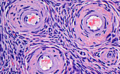 Ovary stroma and blood vessels, light micrograph