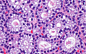 Parathyroid gland cells, light micrograph