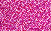 Red blood cells, light micrograph