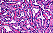 Seminal vesicle epithelium cells, light micrograph