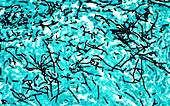 Fungal organism hyphae, light micrograph