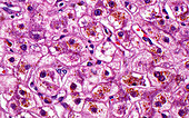 Liver cholestasis, light micrograph