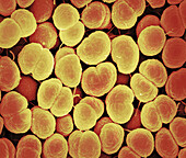 Neisseria gonorrhoeae bacteria, SEM