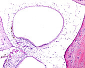 Semicircular canal ampulla, light micrograph