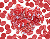 Blood clot, illustration