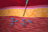 Adalimumab binding tumour necrosis factor-alpha, illustration