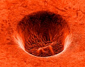 Titanium crater formed by a laser, SEM