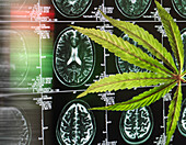 Cannabis leaf at brain scan as curation for dementia and alzheimers