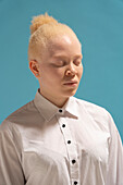 Studioporträt einer Albino-Frau im weißen Hemd