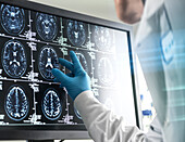 Ein Arzt analysiert den Gehirnscan eines Patienten auf dem Bildschirm