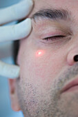 Mann erhält Laserbehandlung im Gesicht