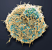 Human Metapneumovirus (HMPV), SEM