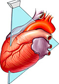 Echocardiogram, illustration