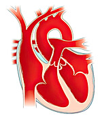 Coronal heart with valves, illustration