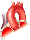 Aortic root, illustration