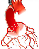 Aortic root, illustration