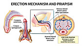 Erection and priapism, illustration