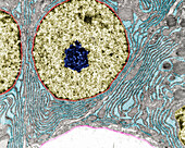 Protein-secreting cell, TEM