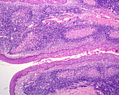 Human palatine tonsil crypt, light micrograph