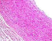 Tunica media of elastic arterya , light micrograph