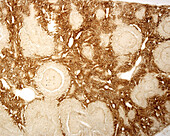 Spleen macrophages, light micrograph