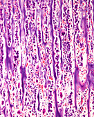 Epiphyseal growth plate, light micrograph