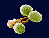 White blood cell attacking Streptococcus pneumoniae bacteria, SEM