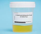 5-hydroxyindoleacetic acid test
