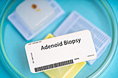 Adenoid biopsy