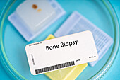 Bone biopsy