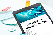 Contraceptive implant insertion