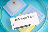 Endoscopic biopsy