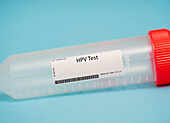 HPV test