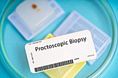 Proctoscopic biopsy