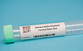 Salivary alpha-amylase/cortisol ratio test