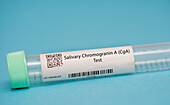 Salivary chromogranin A test