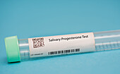 Salivary progesterone test