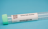 Salivary sialic acid test