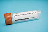 Stool short-chain fatty acid test