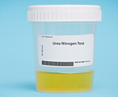 Urea nitrogen test