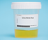 Urine nitrite test