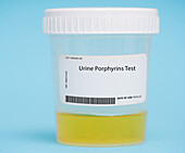 Urine porphyrins test